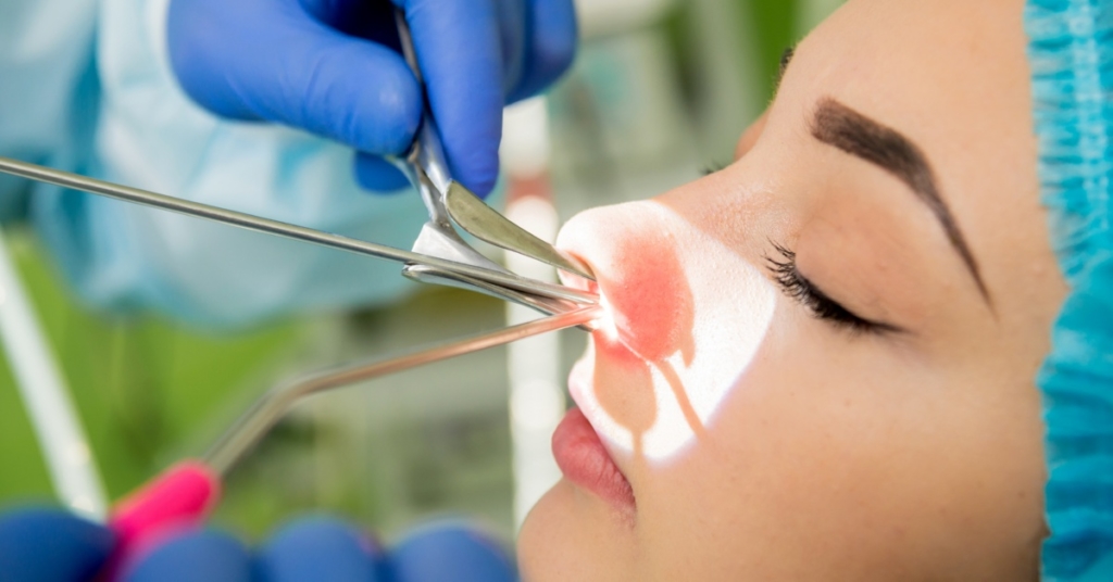 The Total Nose Approach™ NSI Boca