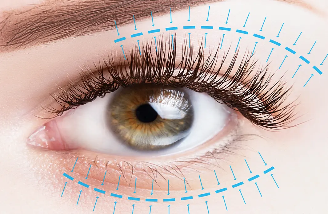 Eyelid Surgery: Restoring Youthful Eyes